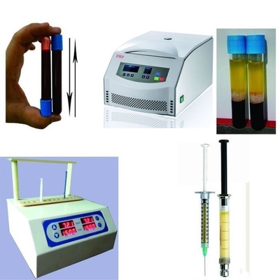 6/8x15ml पोर्टेबल पीआरपी केन्द्रापसारक उपकरण 0-4000rpm कॉस्मेटिक सर्जरी अस्पतालों के लिए