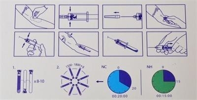 6/8x15ml पोर्टेबल पीआरपी केन्द्रापसारक उपकरण 0-4000rpm कॉस्मेटिक सर्जरी अस्पतालों के लिए